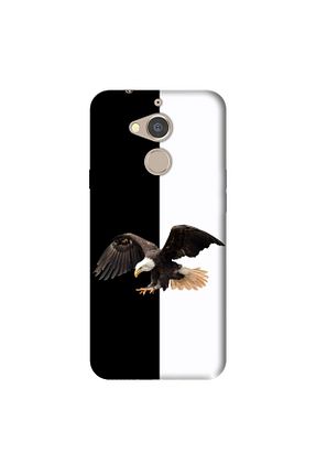 کاور و قاب مشکی General Mobile - کد 286027590