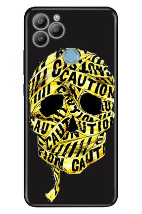کاور و قاب مشکی General Mobile - کد 286044337
