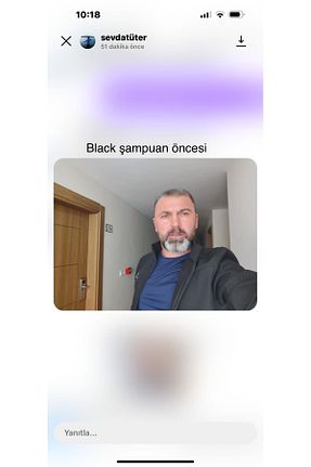 شامپو خشک EGŞ COSMETİCS - کد 866324163