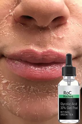 سرم پوست همه انواع پوست roc rochers - کد 868944023