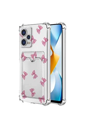 کاور و قاب طلائی MustCase - کد 787554512
