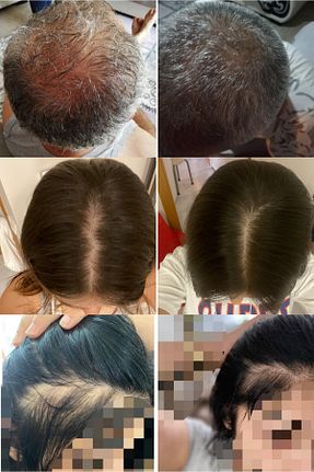 ست مراقبت مو DIAMOND HAIR - کد 797681205