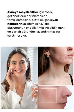 تونیک Yağlı Loth Solutions - کد 831221848