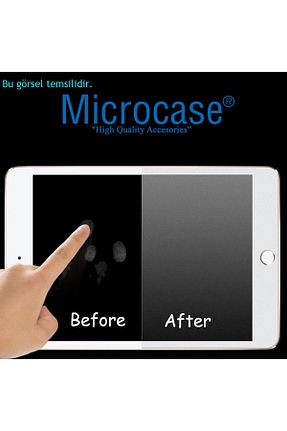 محافظ صفحه تبلت رنگی Microcase - کد 871631115