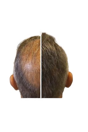 رنگ مو قهوه ای BY UTAH LİSA BELLA - کد 874806338