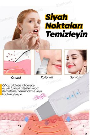 دستگاه پاک کننده صورت سفید Sheland - کد 110686978