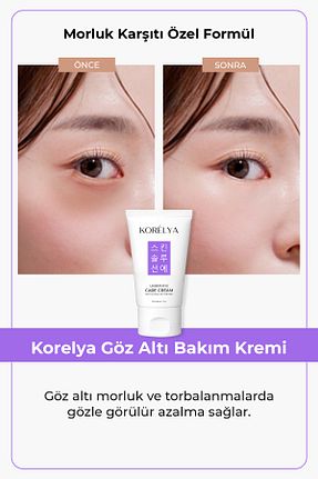 کرم چشم KORELYA - کد 877440697