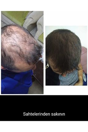 ست مراقبت مو mavi serum - کد 348331363