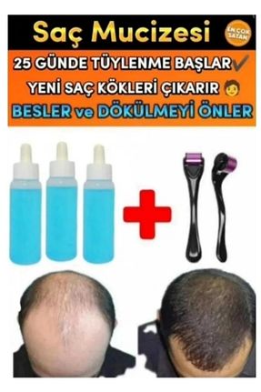 ست مراقبت مو mavi serum - کد 348331363