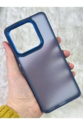 کاور و قاب آبی Vip Case - کد 885389097