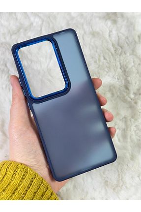 کاور و قاب آبی Vip Case - کد 885409075
