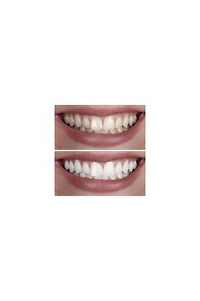 سفید کننده دندان qartz - کد 789282603