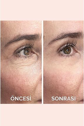 کرم صورت همه انواع پوست VITAYES - کد 118761845