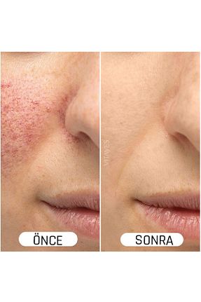 سرم پوست همه انواع پوست VITAYES - کد 118761149