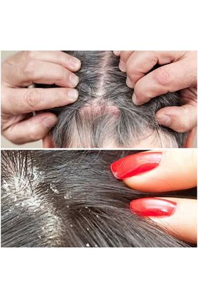 ست مراقبت مو EGŞ COSMETİCS - کد 896239997