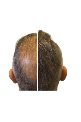 رنگ مو قهوه ای BY UTAH LİSA BELLA - کد 874805662