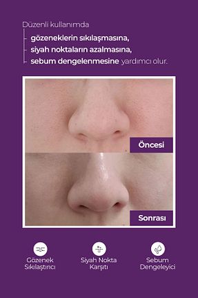 تونیک همه انواع پوست Superyou - کد 898392663
