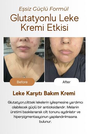 کرم صورت همه انواع پوست Roen - کد 831687377