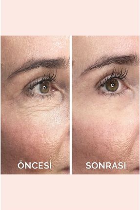 کرم صورت همه انواع پوست VITAYES - کد 118761367