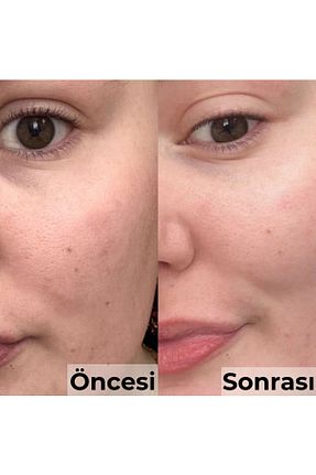 سرم پوست همه انواع پوست Peluş Dünyam - کد 903292879