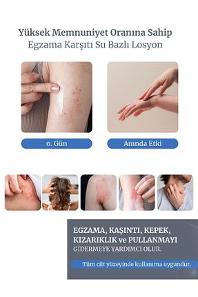 کرم صورت همه انواع پوست izderma - کد 357170445