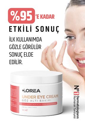 کرم چشم Aydınlatıcı Clorea - کد 903759248