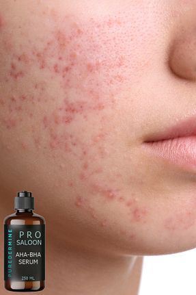 پیلینگ صورت Leke Karşıtı Bakım Puredermine - کد 905811325