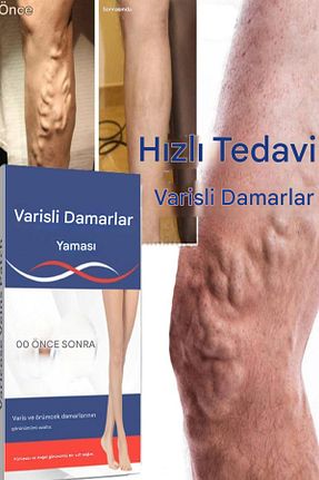 جوراب واریس رنگی ESENLİWE - کد 903406768