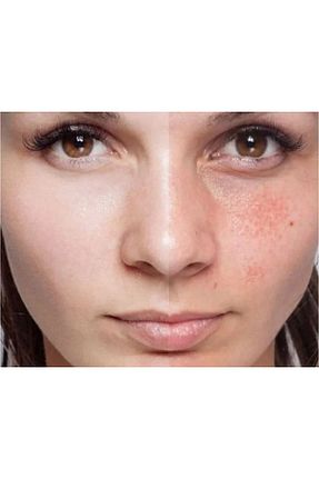ست مراقبت پوست Mardinal - کد 904887141