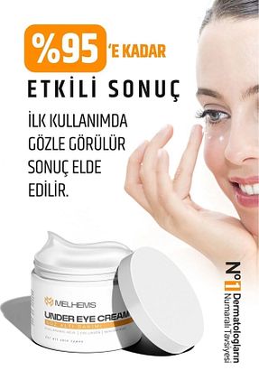 کرم چشم MelhemS - کد 920872793