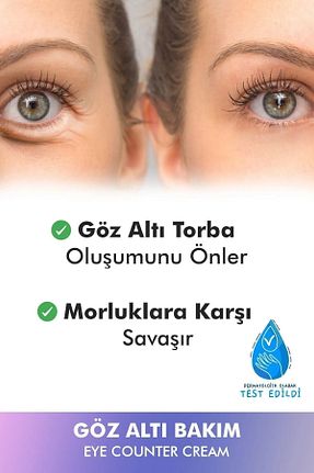 کرم چشم Sherka - کد 920884001