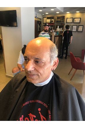 سایر اکسسوری مو آبی مردانه İNTERPROTEZ - کد 839426193