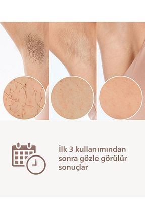 دستگاه لیزر موهای زائد IPL بژ Kablosuz Philips - کد 922158266