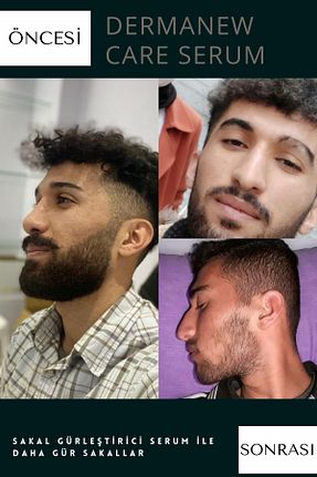 ویتامین مو dermanew hair - کد 923141344