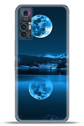 کاور و قاب رنگی TCL - کد 664017930