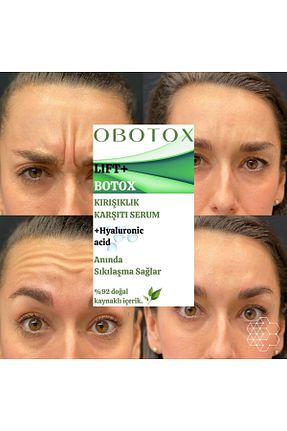 سرم پوست همه انواع پوست OBOTOX - کد 928968612