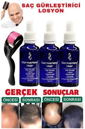 ست مراقبت مو dermanew - کد 929180557