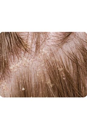 شامپو خشک Egş DERMA delete - کد 928684638