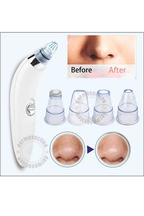 دستگاه پاک کننده صورت سفید dermasuction - کد 166574777