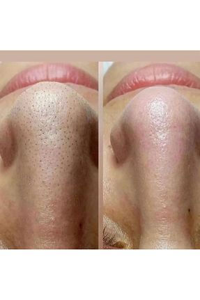 شامپو زنانه Egş DERMA delete - کد 930422094