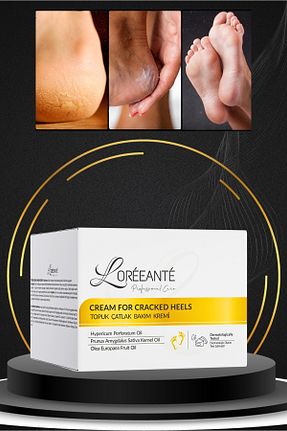کرم پا Loréeanté - کد 922778697