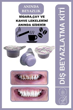 سفید کننده دندان AVANT DENTAL SUPPLY - کد 904296915