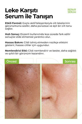 سرم پوست همه انواع پوست KEIN - کد 936801986