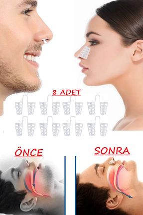 چسب بینی Nordmende - کد 82297659