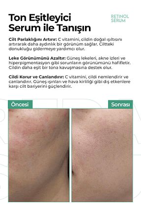 سرم پوست همه انواع پوست KEIN - کد 936801944