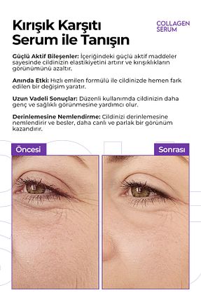 سرم پوست همه انواع پوست KEIN - کد 936955517