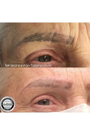 سرم ابرو و پلک S-İRON COSMETİC - کد 57252313