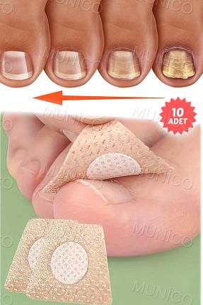 ناخن مصنوعی و اکسسوری بژ Munico - کد 940071528