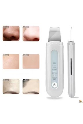 دستگاه پاک کننده صورت سفید SİNKA - کد 68901138