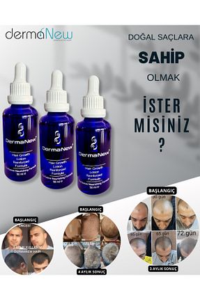 روغن و سرم مو dermanew hair - کد 795524031